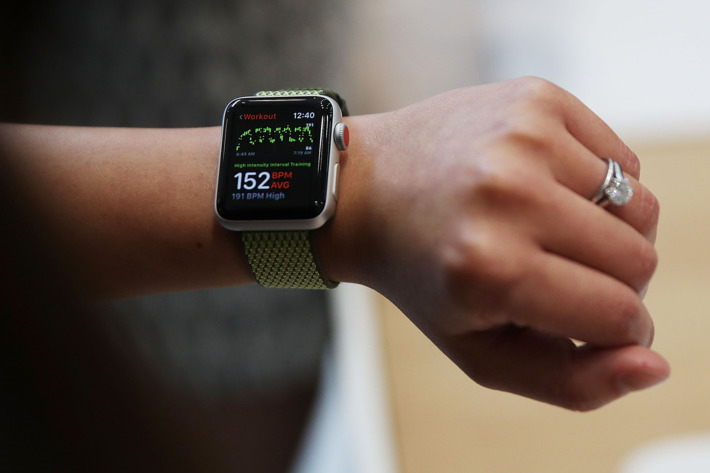 Vers une Apple Watch qui veille sur votre peau ?